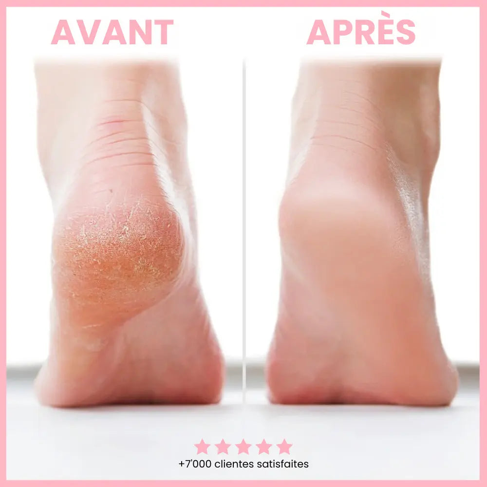 Foot Glow - L'Original