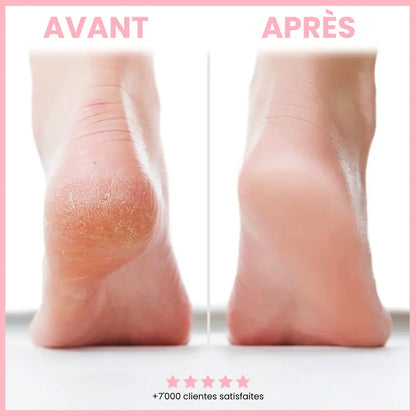 Foot Glow - L'Original